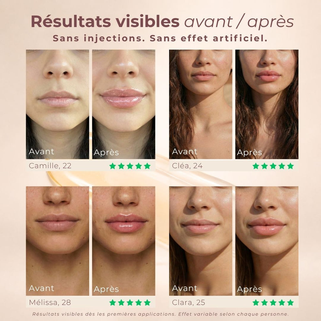 Des lèvres plus pulpeuses en quelques minutes, sans injections
